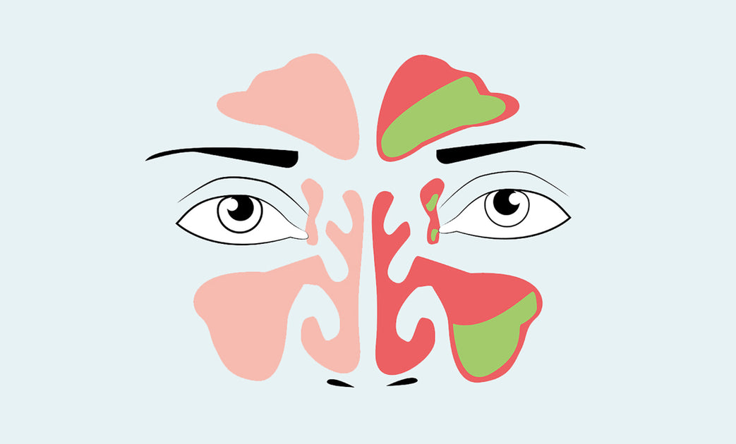 7 Natural Ways to Clear Blocked Sinuses - How to Clear Sinus Blockage ...